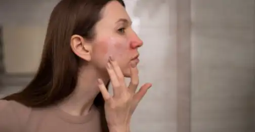 Is Ecodoin suitable for sensitive skin?